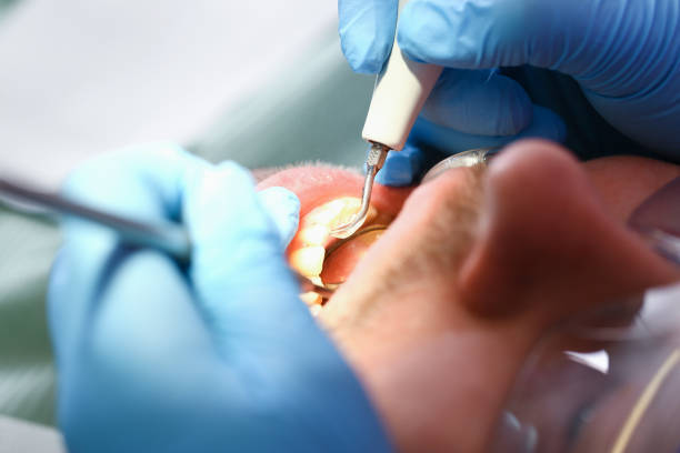 Best Cosmetic Emergency Dentistry in Monticello, KY