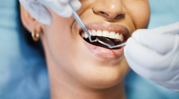 Best Emergency Dental Care for Broken or Chipped Teeth in Monticello, KY