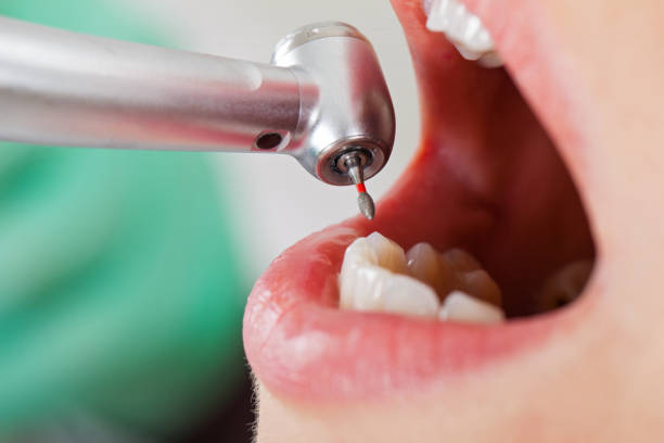 Best Emergency TMJ Treatment in Monticello, KY